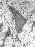 Profile Picture of Mesenchymeon Wikipedia