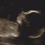 Michael Dundon - Instagram Profile Picture of Michael Dundon (@michael.dundon) on Instagram