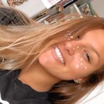 Profile Picture of Abigail Ackers (@abigailackers) on Instagram
