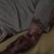 Profile Picture of Aaron's Arm (@AaronsArm1) on Twitter