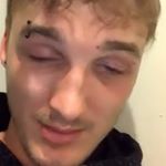 Profile Picture of Alex James Simpson (@blitzedbonez) on Instagram