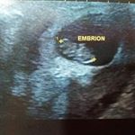 Profile Picture of Dora Campos (@doracampos027) on Instagram