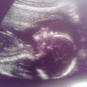 Profile Picture of April Hyman (@kingtigertkd) on Myspace