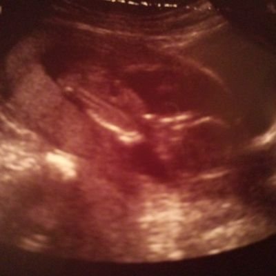 Profile Picture of Angela Anglin (@angelaanglin16) on Twitter