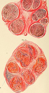 Profile Picture of Neuritison Wikipedia