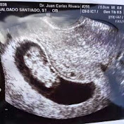 Profile Picture of Pedro Cepeda (@pedrocepeda183) on Youtube