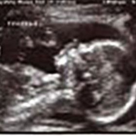 Profile Picture of Lisa Pestrella (@sexytrish_davis07) on Myspace