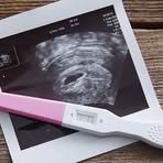 Profile Picture of Calleb Martinelli Germanota (@Calleb-Martinelli-Germanota) on Facebook