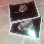 Profile Picture of Darrien Skye Nikole Kirby (@darrienskyenikolekirby) on Instagram