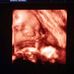 Profile Picture of Lorenzo Aleman (@lorenzo.aleman.7906) on Facebook