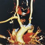 Profile Picture of Radiologi Rs jantung Harkit (@radiologipjnhk) on Instagram