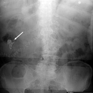 Profile Picture of Noureen Mirza (@aroushanoureen) on Twitter