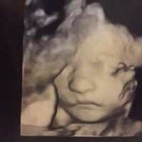 Profile Picture of Michael Rausch (@michael-rausch-10) on Quora