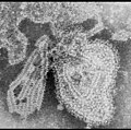 Profile Picture of Mumps viruson Wikipedia