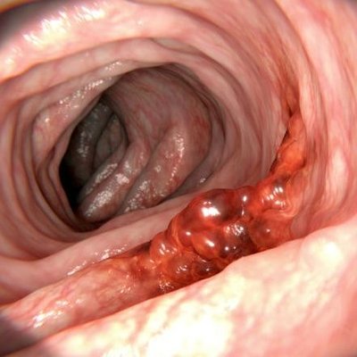 Profile Picture of Devin Nunes's Colon (@ColonDevins) on Twitter