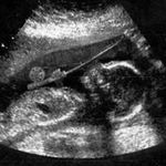 Profile Picture of Craig Severson (@craigmacaronincheese) on Instagram