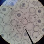 Profile Picture of Lynnette Walker (@lynniewalkr6) on Instagram