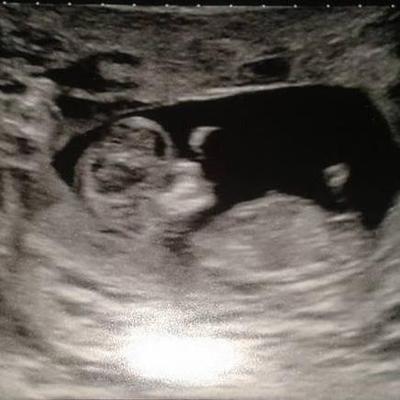 Daniel Worthy - Twitter Profile Picture of Daniel Worthy (@daniel_worthy) on Twitter