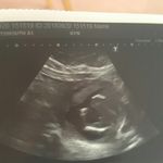 Profile Picture of Hector Aimen (@hectoraimen_) on Instagram