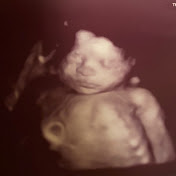 Profile Picture of Michael Parrilla (@michaelparrilla6461) on Youtube