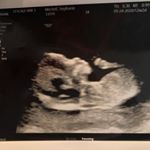 Profile Picture of CyrusEugeneMitchell (@cyruseugenemitchell) on Instagram