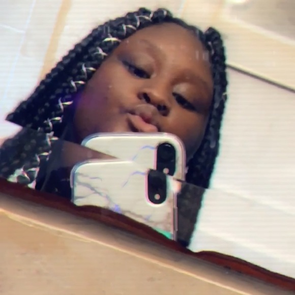 Profile Picture of Kassie Duplessy (@bracexfacekayy) on Poshmark