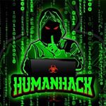 Matthew Ronald Jaye Winn - Instagram Profile Picture of Matthew Ronald Jaye Winn (@human_hack) on Instagram