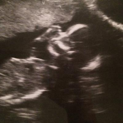 Profile Picture of Brittney Tuttle (@Iamcoolyouare) on Twitter