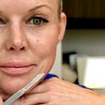 Profile Picture of Dawn Hawley   ⚡️1skinwizard⚡️ (@1skinwizard) on Instagram