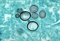 Profile Picture of Paracoccidioidomycosison Wikipedia