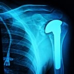 Randall Plankenhorn - Instagram Profile Picture of Randall Plankenhorn (@0rand) on Instagram