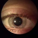 Profile Picture of Aleksandra Ciszewska-Oss (@optometryphotos) on Instagram