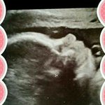 Profile Picture of Dirkje Wallbrink (@dirkjewallbrink) on Instagram