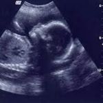 Profile Picture of Lucas sau Daria (@bebe_dmf._) on Instagram