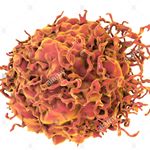 Profile Picture of Aldred Scott Warthin 🙌🏻🍑🔬 (@colon_cancer_1913) on Instagram