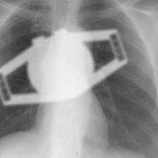 Profile Picture of Kenny Lam (@beemerrider100) on Youtube