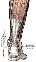 Profile Picture of Tendinopathyon Wikipedia