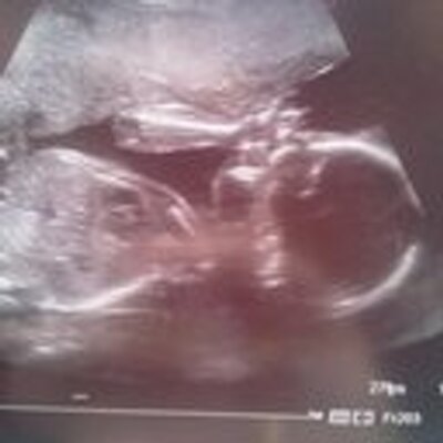 Profile Picture of Robin Levy (@robinlevy16) on Twitter