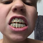 Profile Picture of Brody Michael Klarer (@brody_klarer) on Instagram