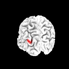 Profile Picture of Drugexposedkids (@kylierex) on Twitter