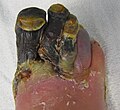 Profile Picture of Gangreneon Wikipedia