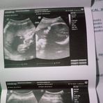 Profile Picture of Alaizha Shayne Bautista Amante (@Alaizha-Shayne-Bautista-Amante) on Facebook