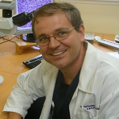 Profile Picture of Anthony J Gill (@CaDxPath) on Twitter