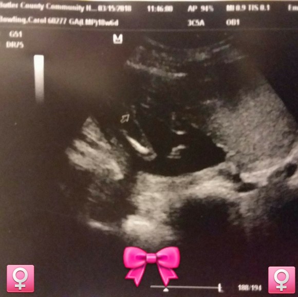 Profile Picture of Adam Lenos (@babyfacelenos) on Poshmark