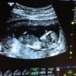 Profile Picture of Tim Mercer (@timothymercer) on Instagram