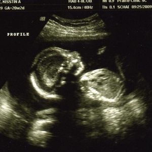 Profile Picture of Cj Lange (@momsrmyspecialty) on Myspace