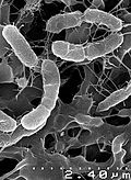 Profile Picture of Venenivibrio stagnispumantison Wikipedia