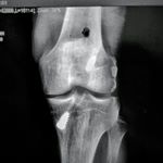 𝐉𝐨𝐡𝐧 𝐈𝐚𝐧𝐧𝐢, 𝐏𝐓, 𝐃𝐏𝐓 ⚕️ - Instagram Profile Picture of 𝐉𝐨𝐡𝐧 𝐈𝐚𝐧𝐧𝐢, 𝐏𝐓, 𝐃𝐏𝐓 ⚕️ (@dr.johnianni_dpt) on Instagram