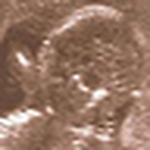 Ariel Moreno - Flickr Profile Picture of Ariel Moreno (@ariel moreno) on Flickr