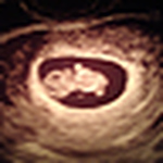 Profile Picture of Kenneth Pollin (@mia gloria pollin) on Flickr